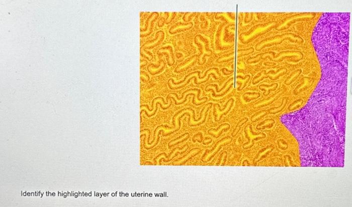 Identify the highlighted structure of the uterine tube.