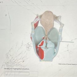 Identify the highlighted structure of the uterine tube.