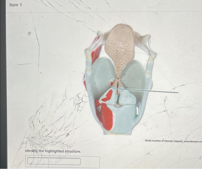 Identify the highlighted structure of the uterine tube.