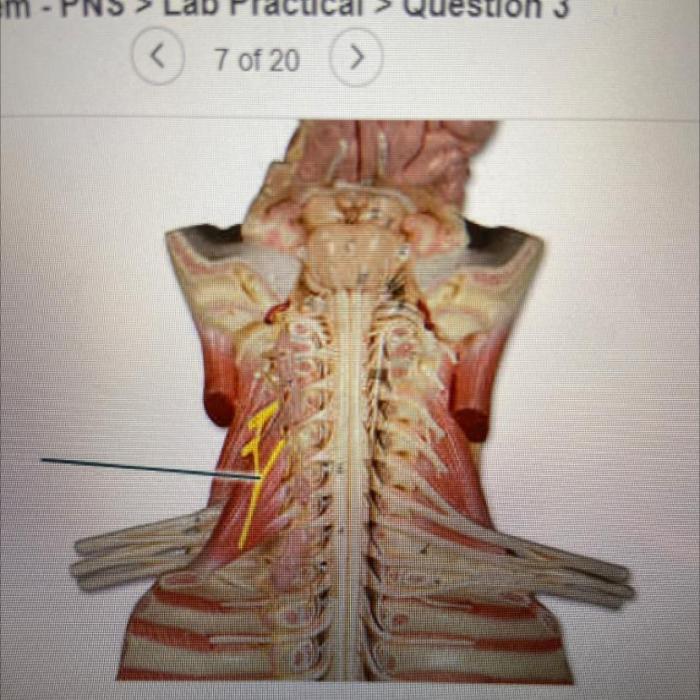 Identify the highlighted structure of the uterine tube.